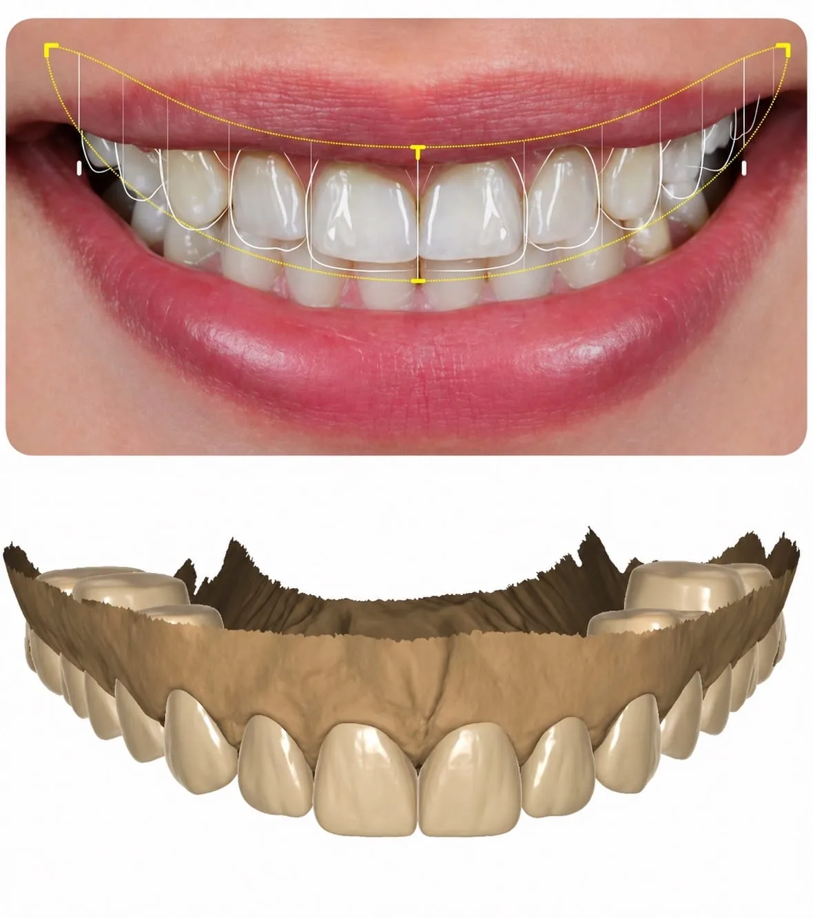 Planejamento digital para cirurgia