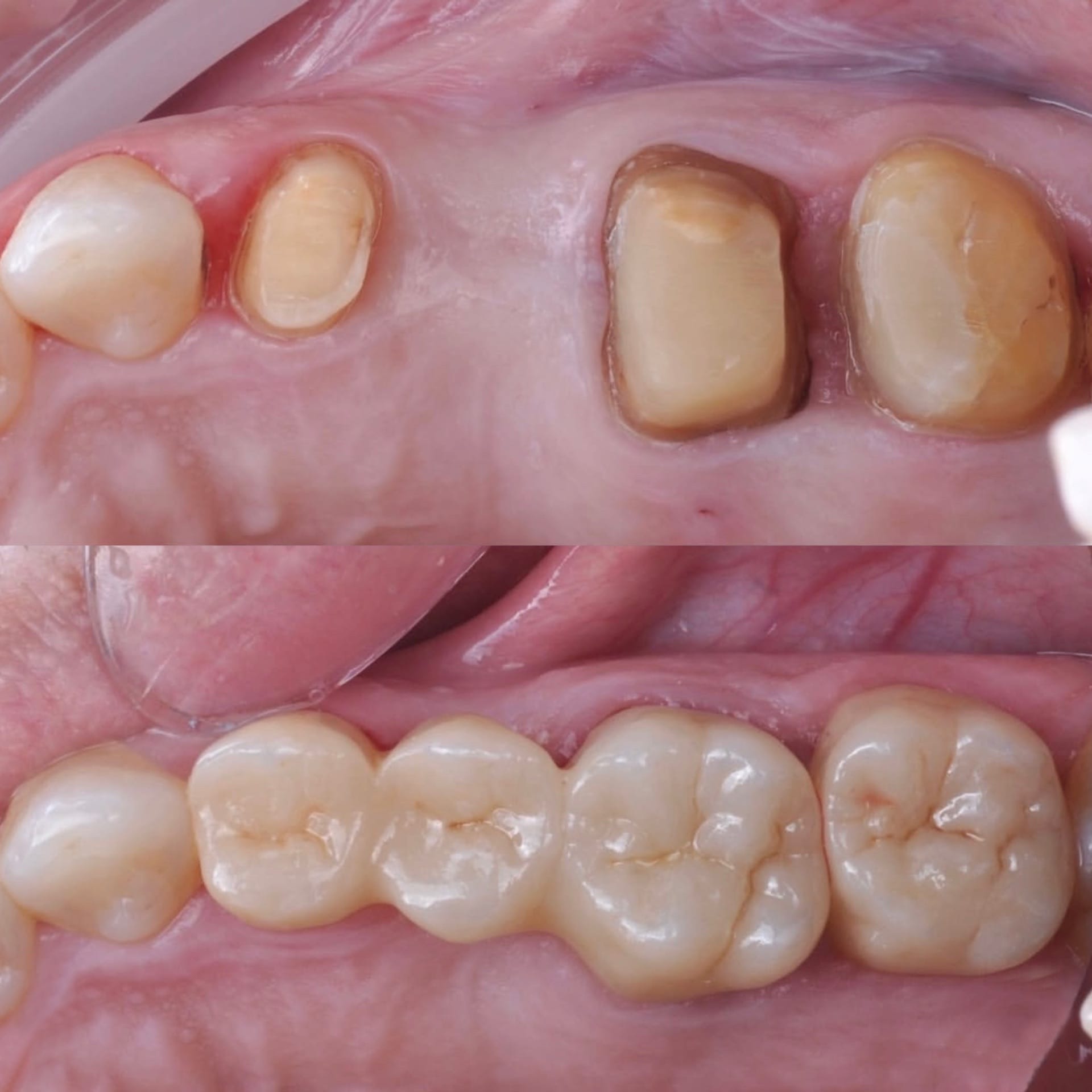 Resultado transformacao sorriso