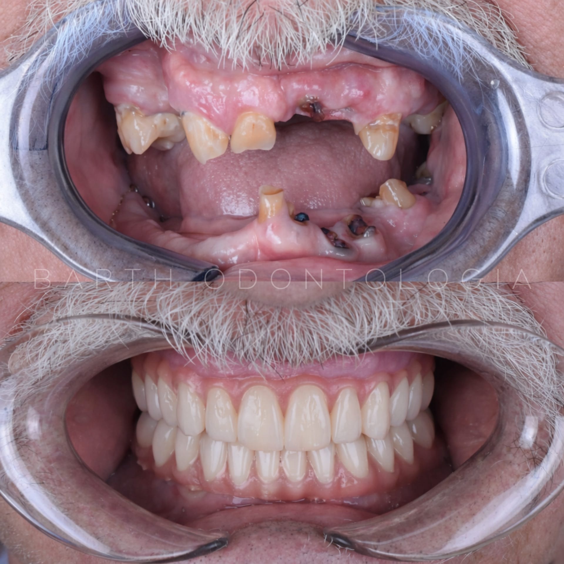 Resultado transformacao sorriso