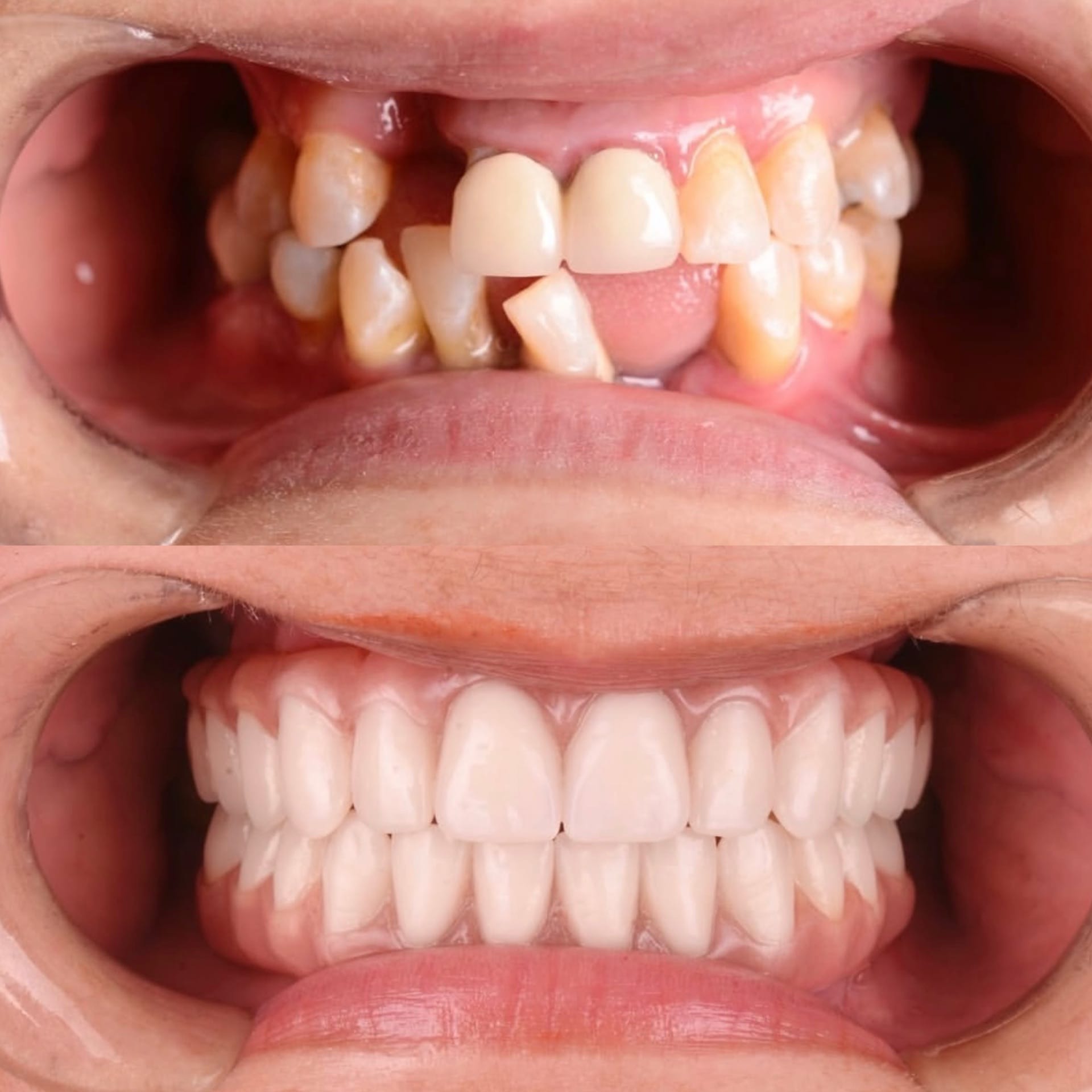 Resultado transformacao sorriso