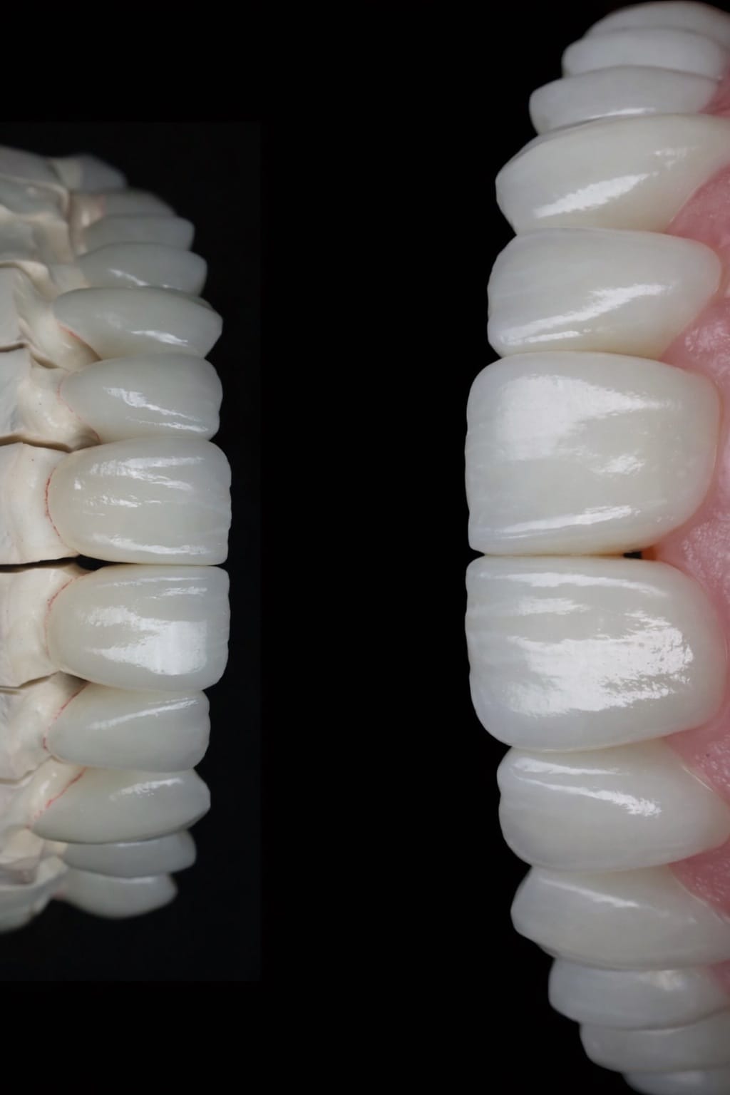 Resultado transformacao sorriso