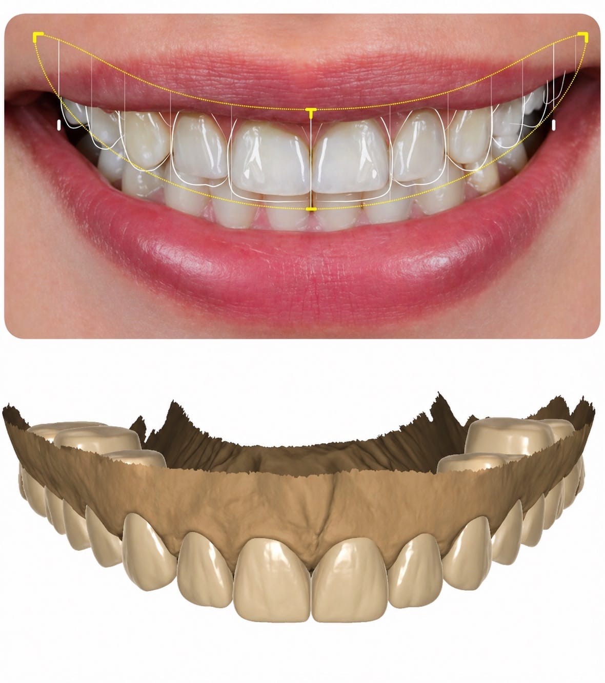 Resultado transformacao sorriso