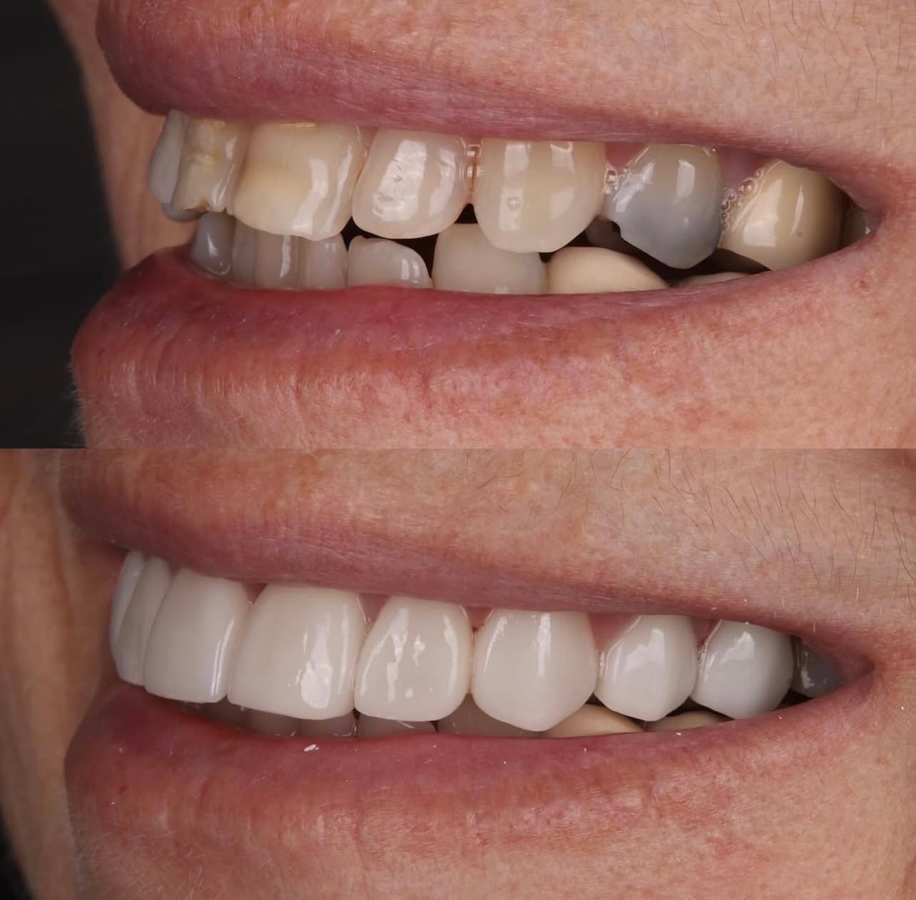 Resultado transformacao sorriso
