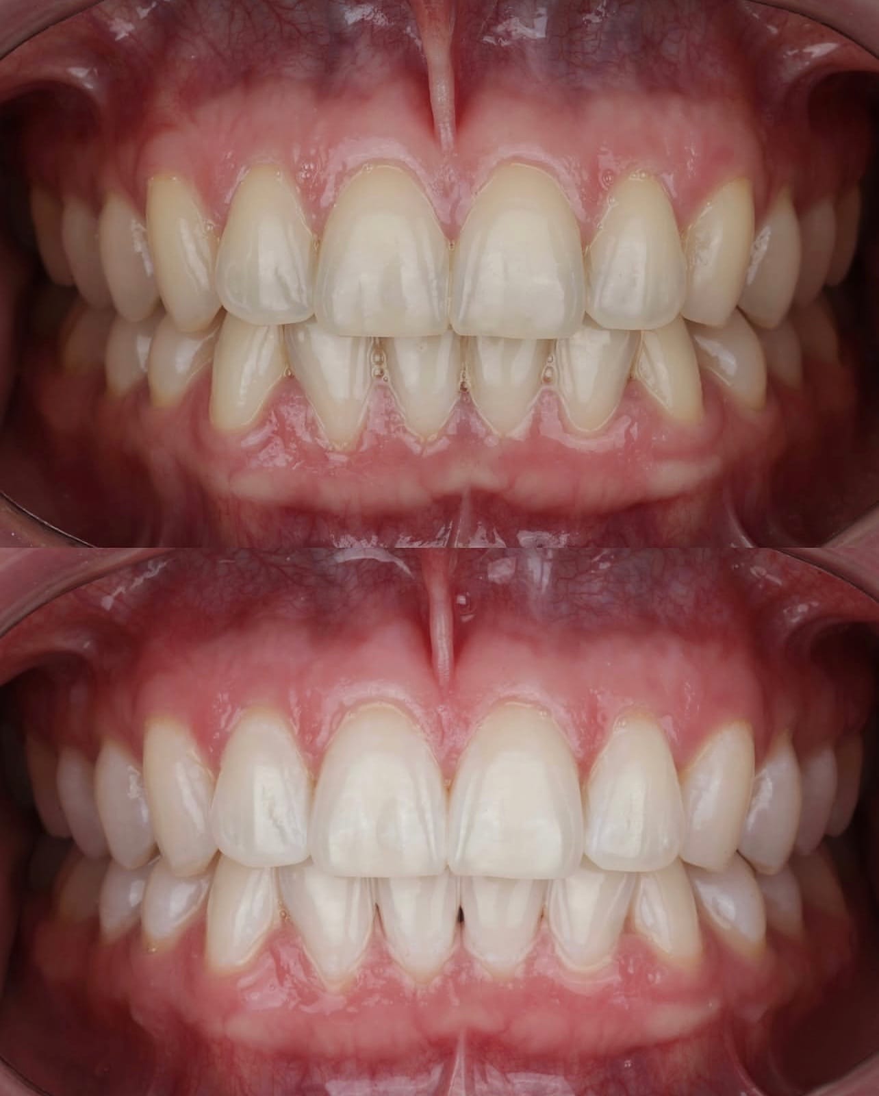 Resultado transformacao sorriso
