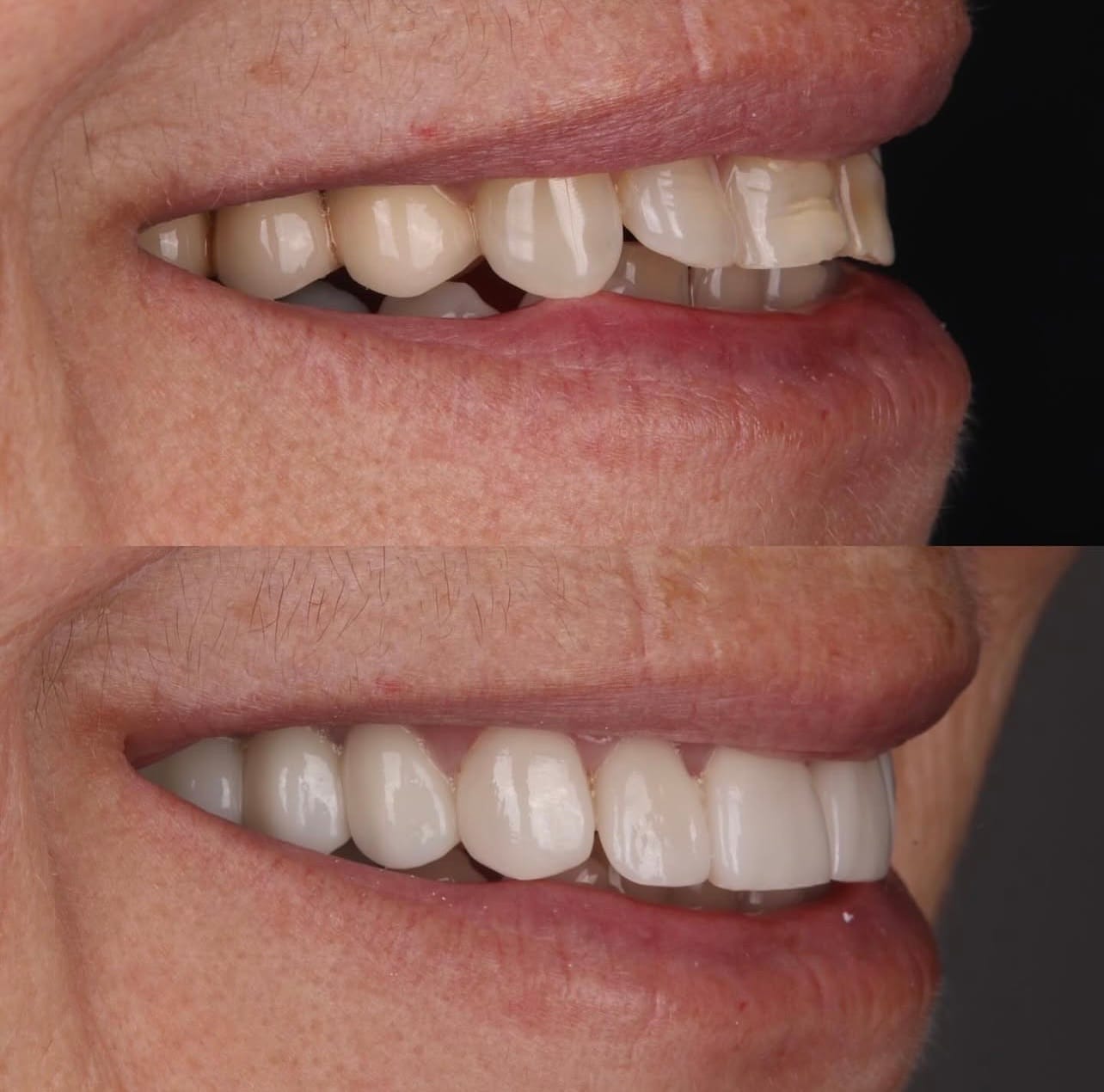 Resultado transformacao sorriso