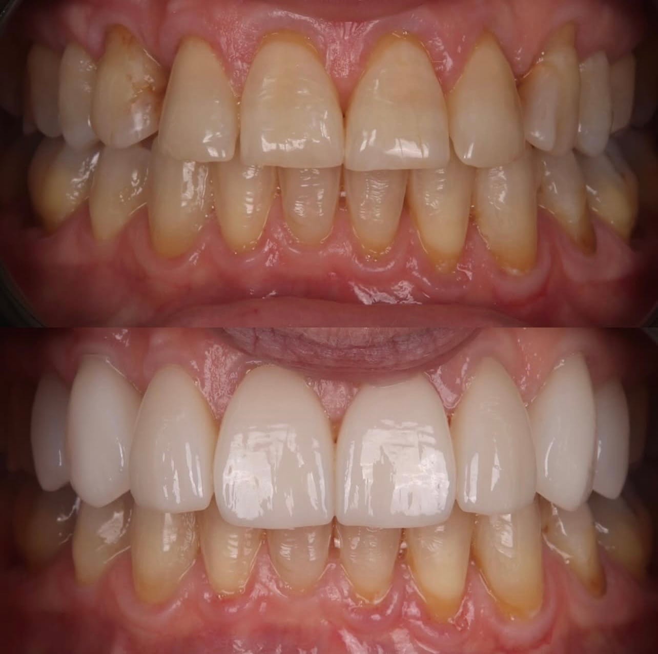 Resultado proteses-dentarias