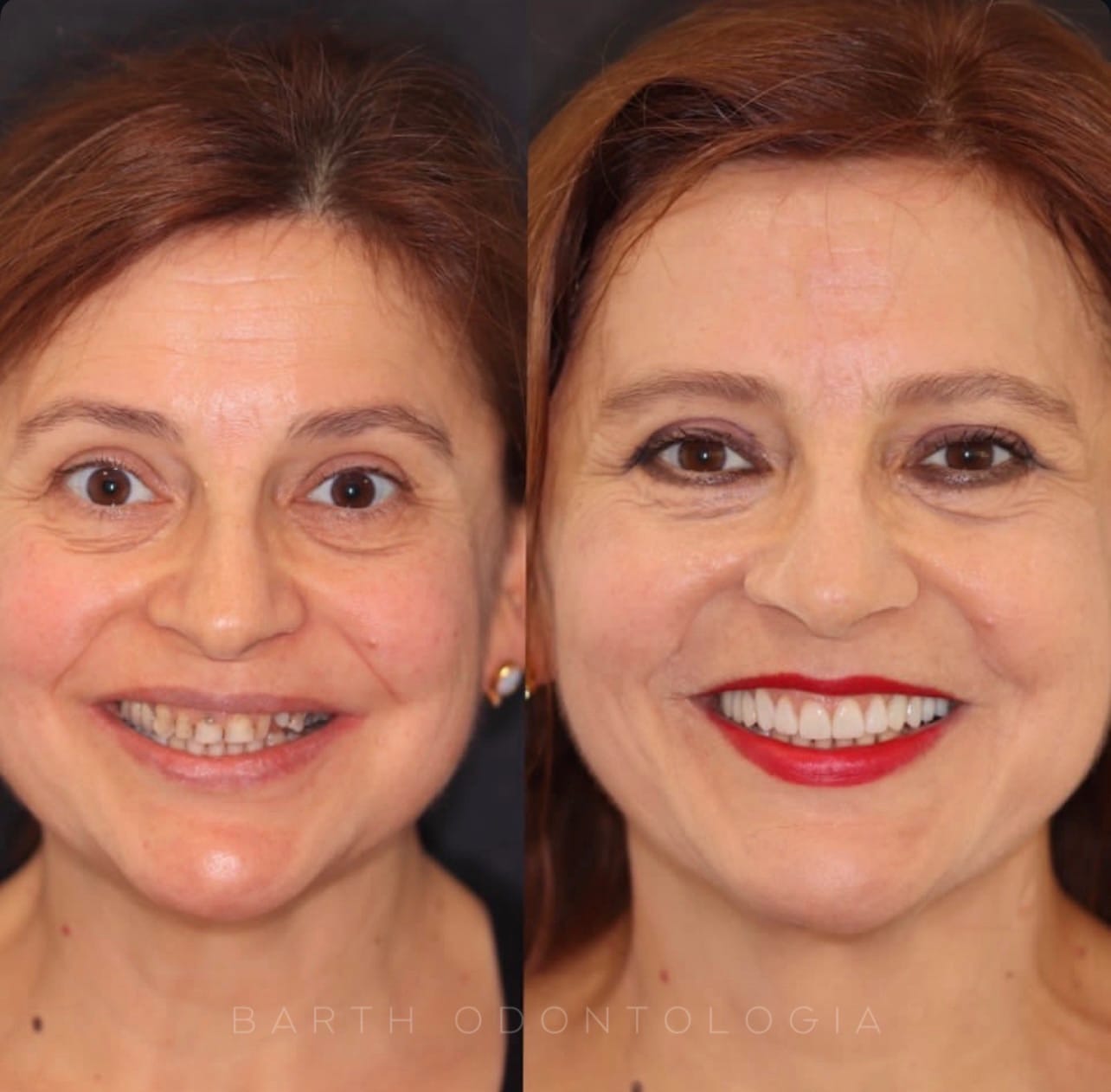 Resultado transformacao sorriso