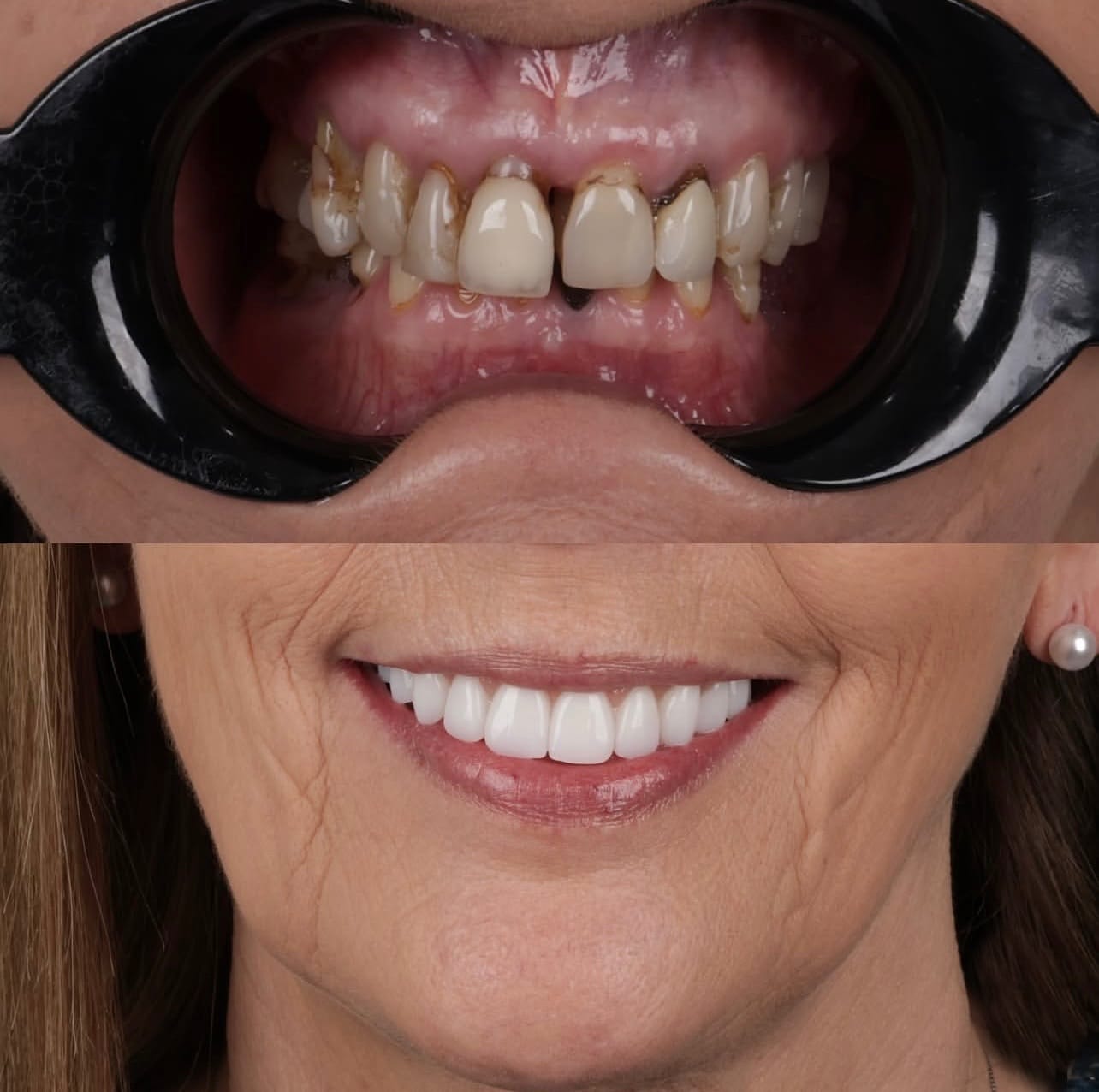 Resultado transformacao sorriso