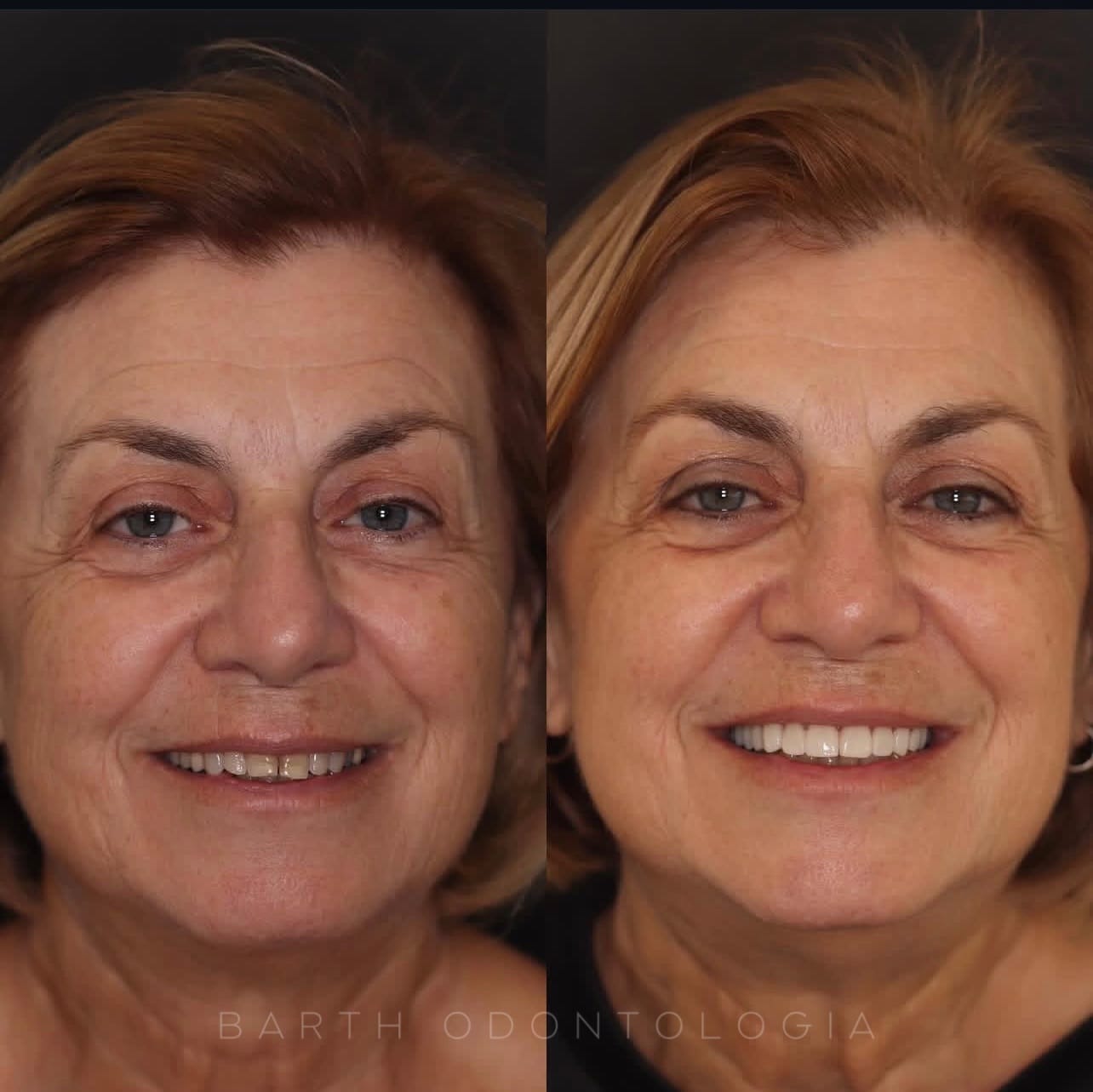 Resultado transformacao sorriso