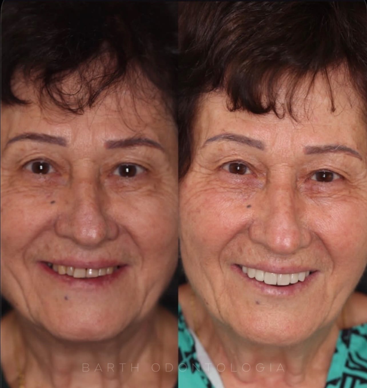Resultado transformacao sorriso