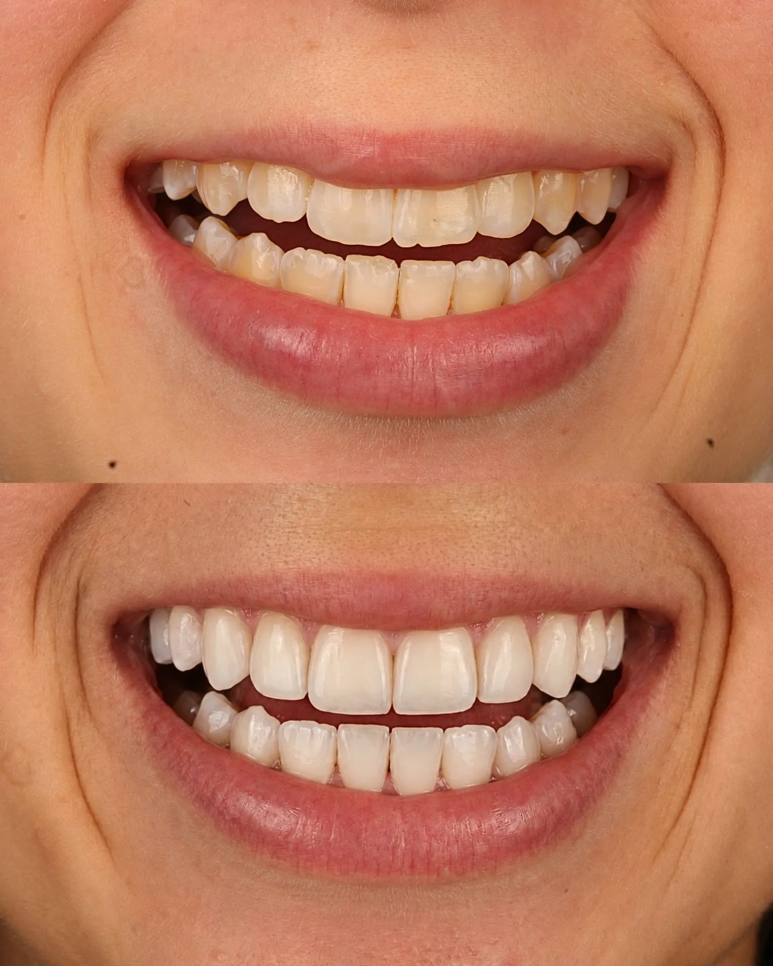 Resultado transformacao sorriso