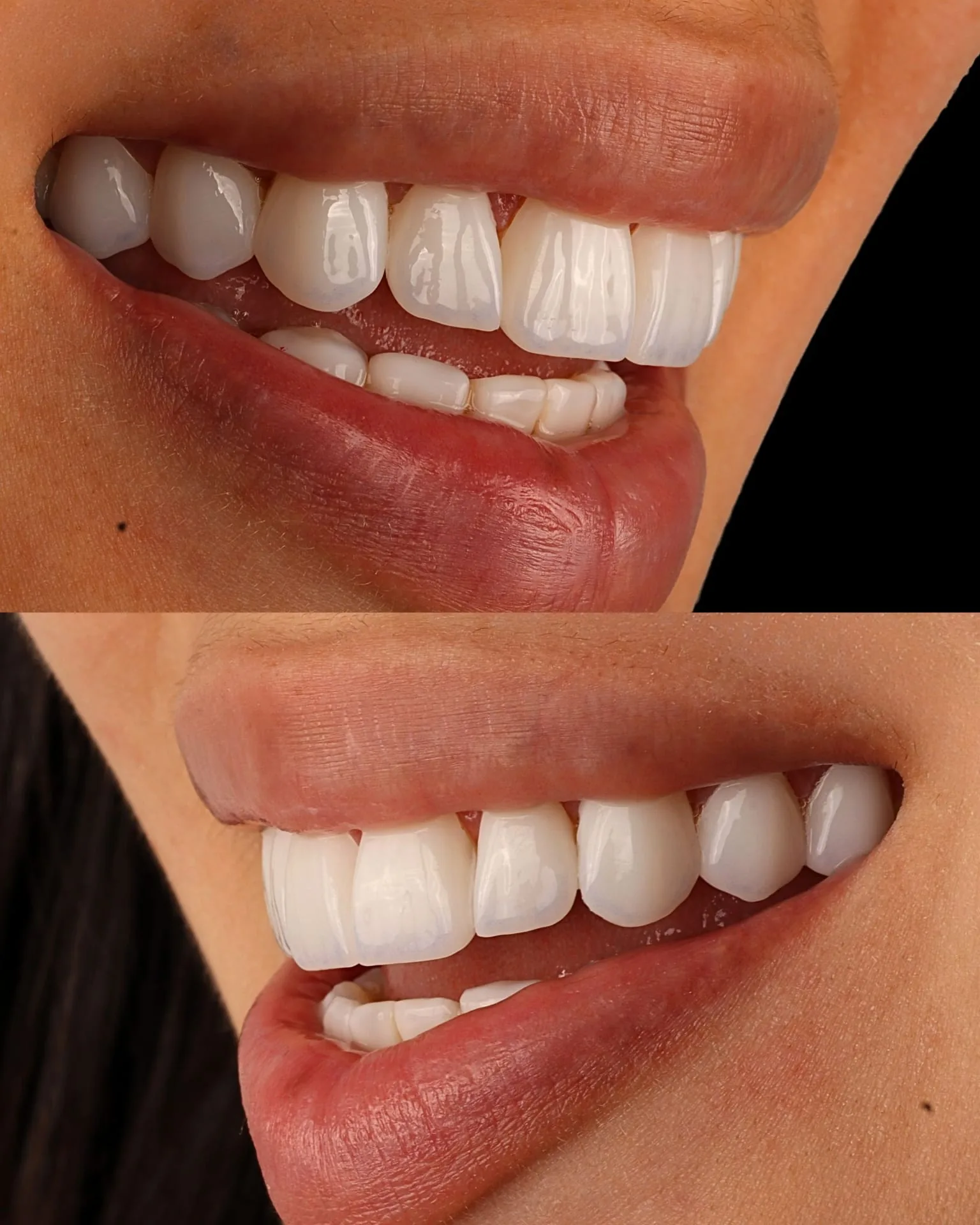 Resultado transformacao sorriso
