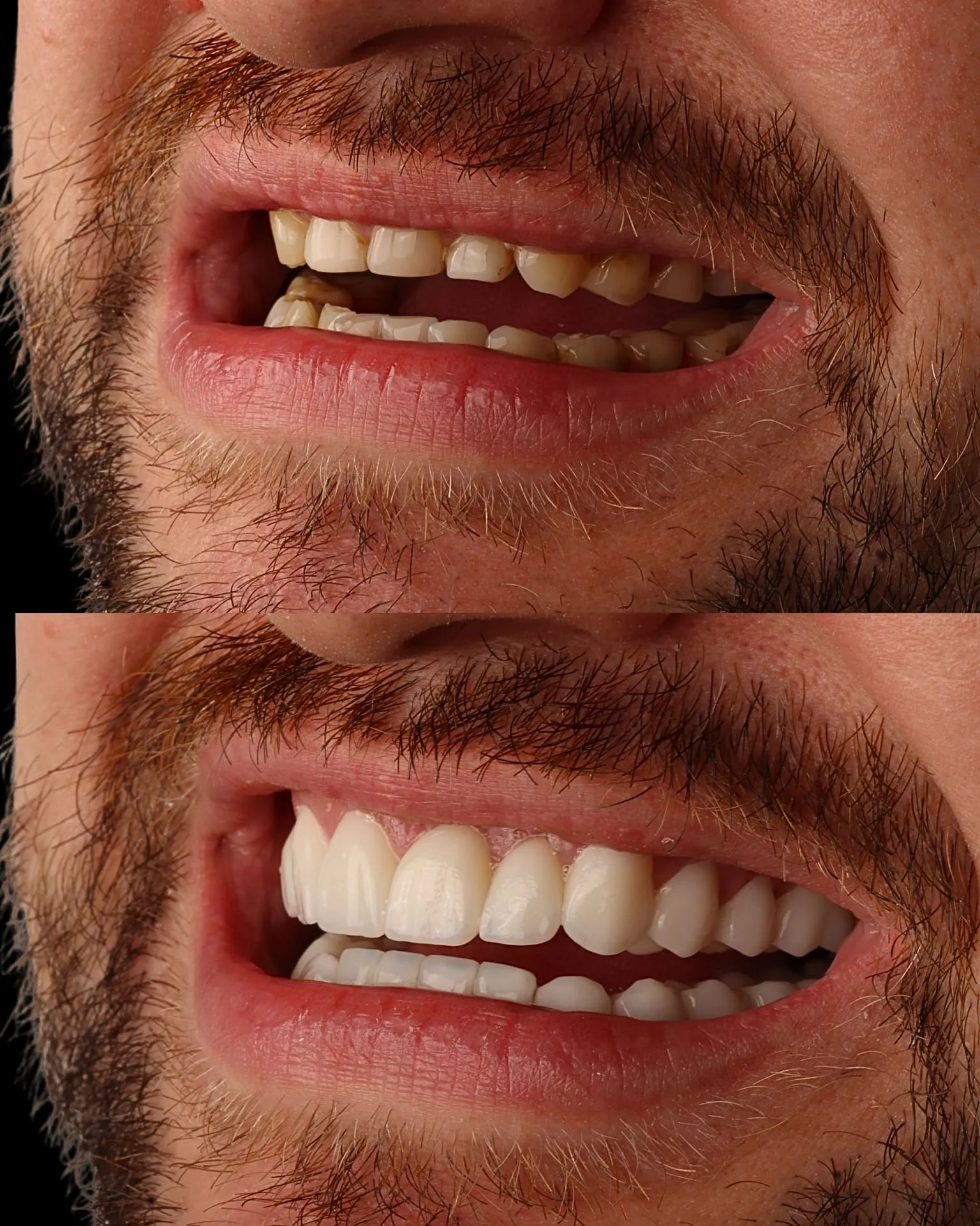Resultado transformacao sorriso