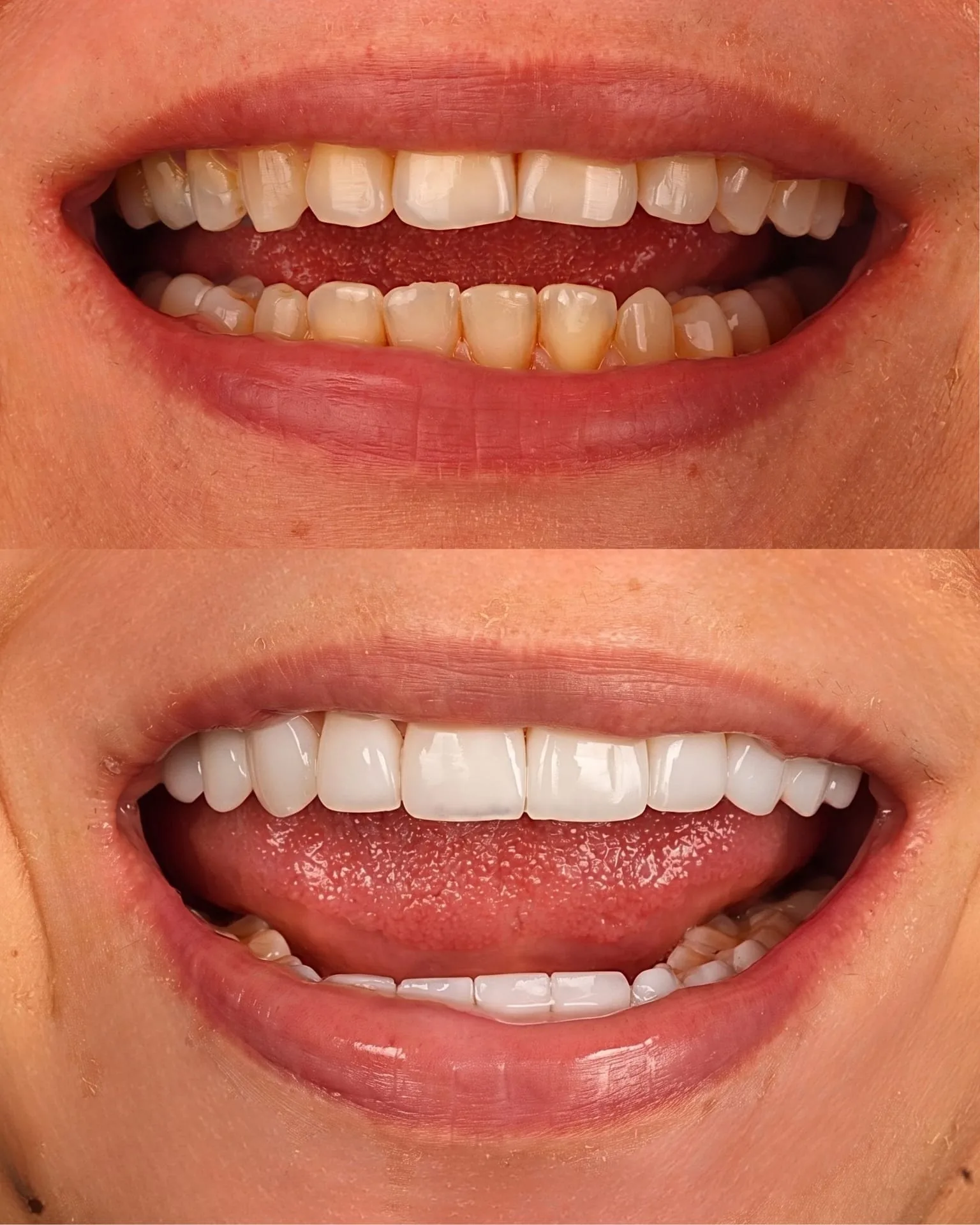 Resultado transformacao sorriso