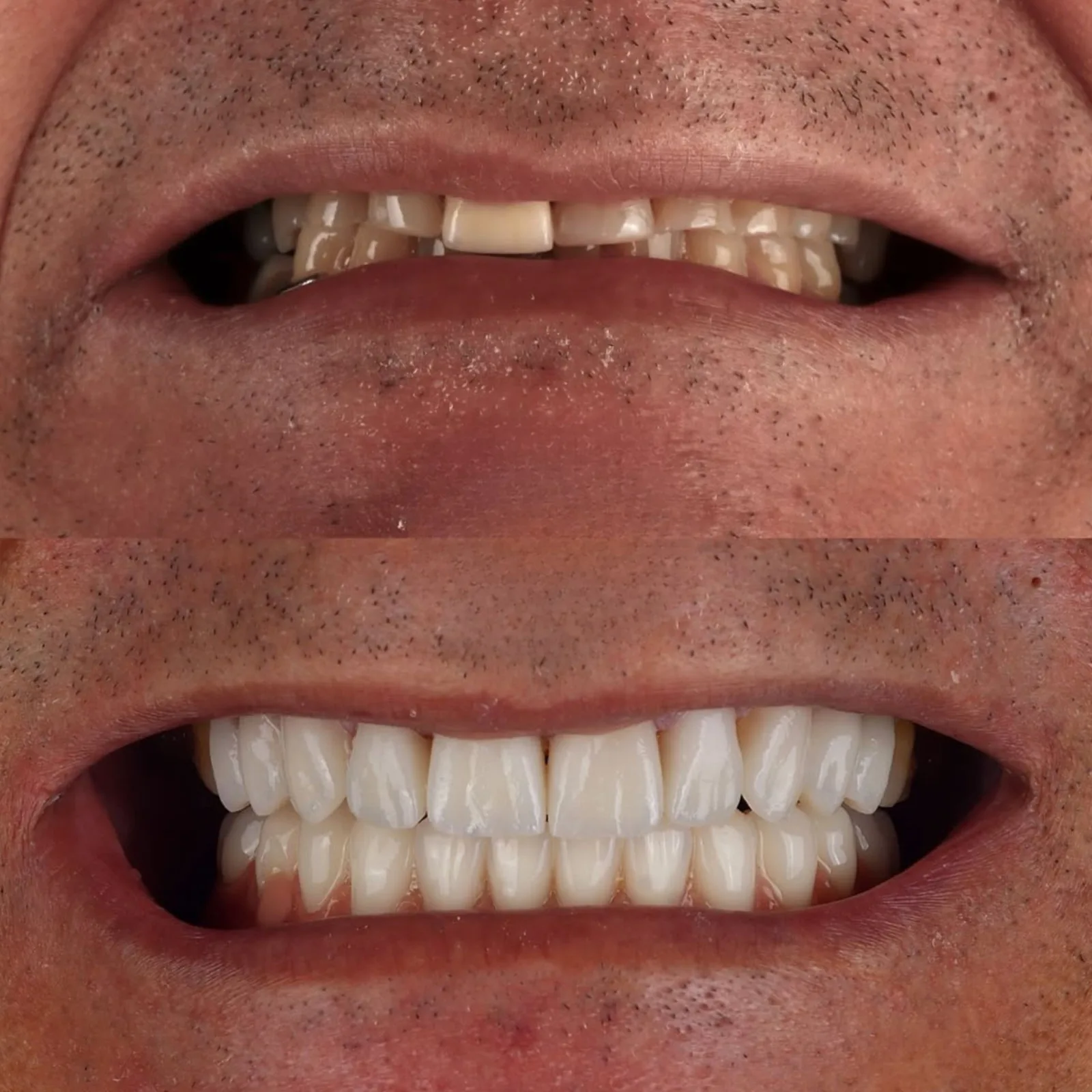 Resultado transformacao sorriso