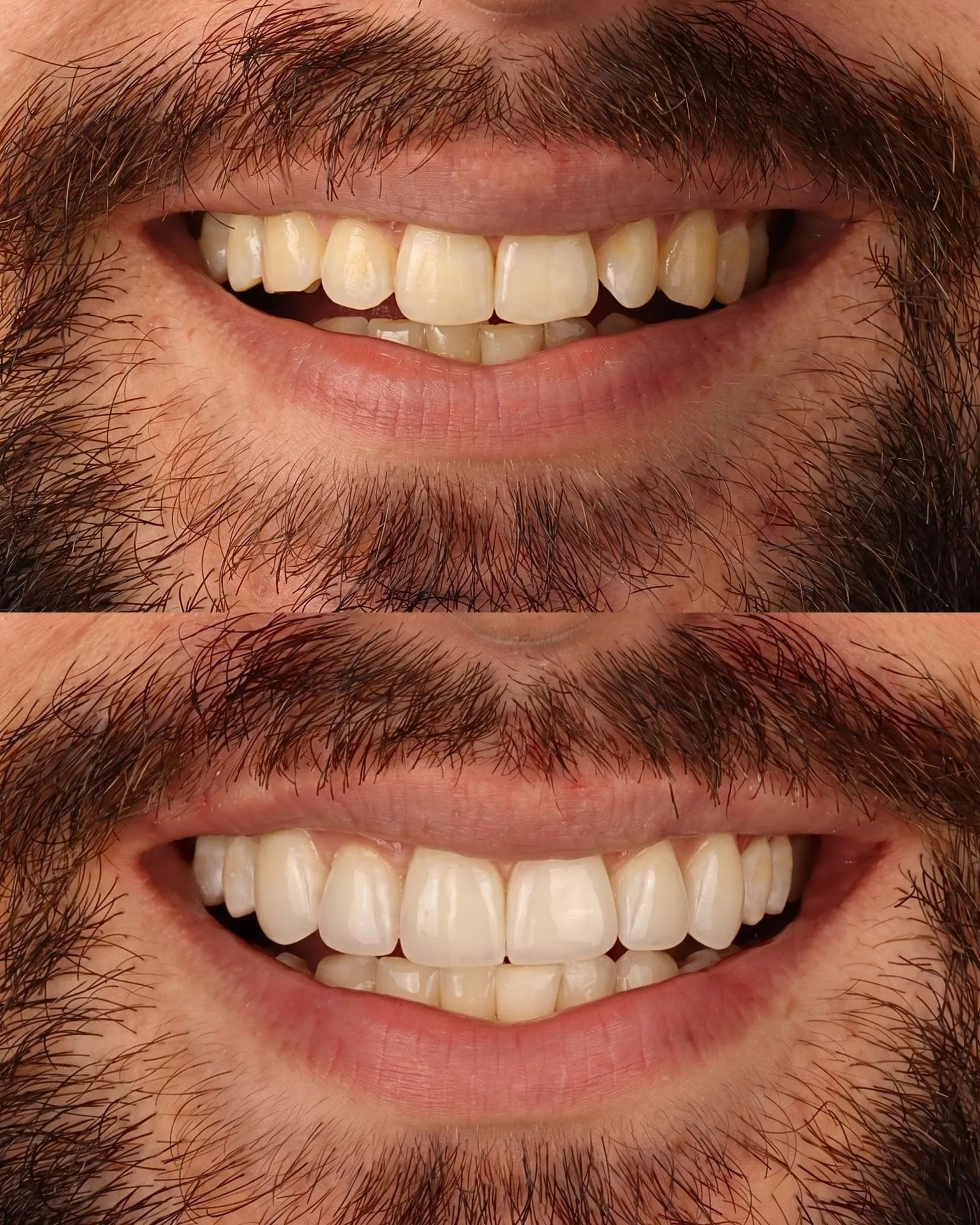 Resultado transformacao sorriso