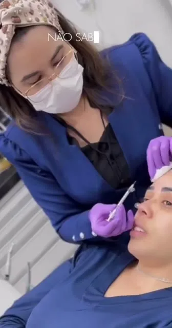 Depoimento Botox Estético