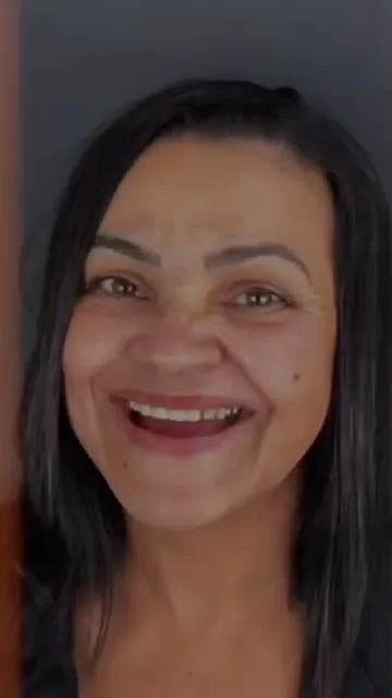 Depoimento Implantes Dentários