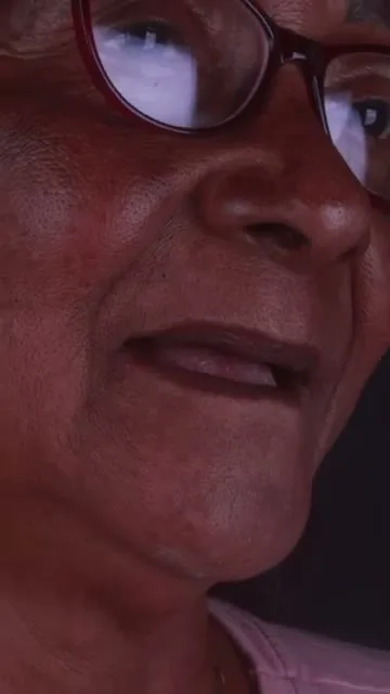 Depoimento Implantes Dentários