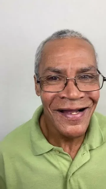 Depoimento Implantes Dentários