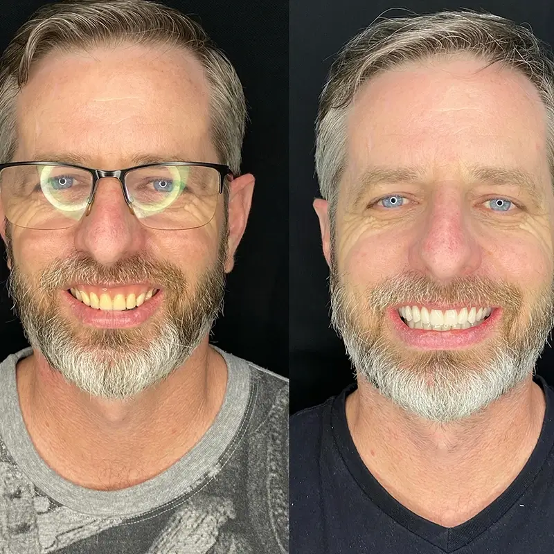 Caso real 1, antes e depois