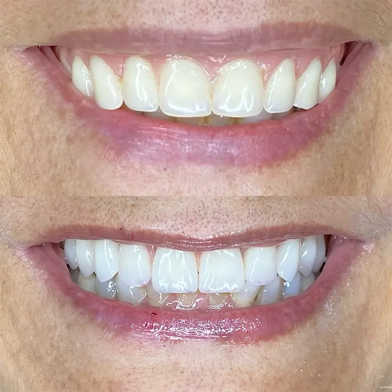 Caso real 2, antes e depois