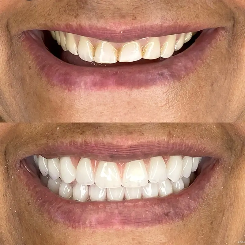 Caso real 3, antes e depois
