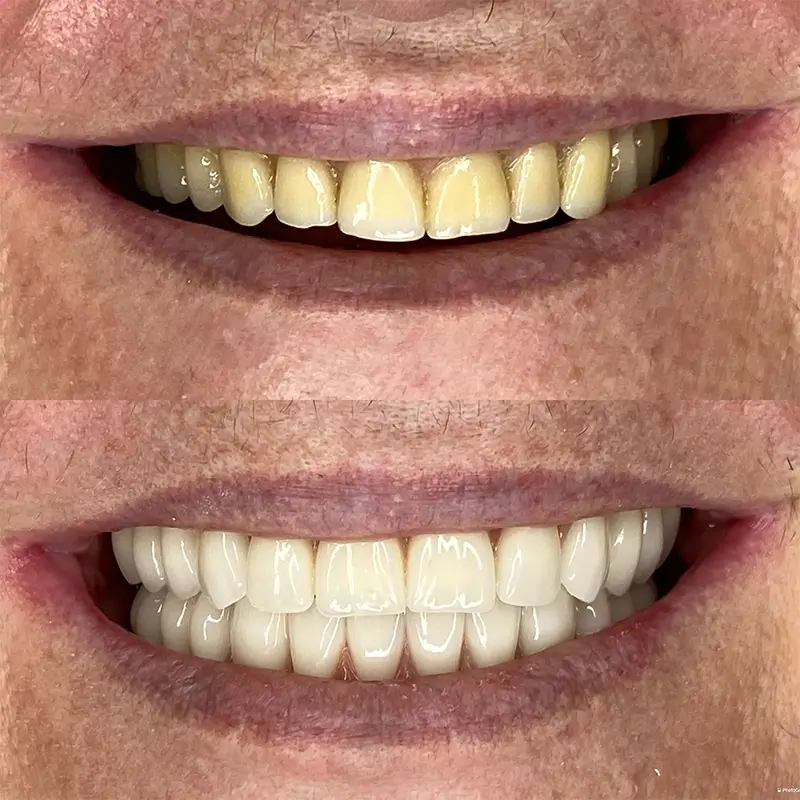 Caso real 4, antes e depois