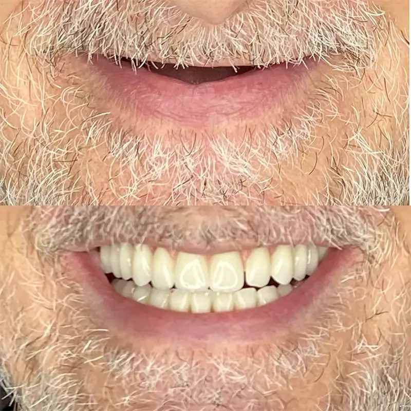 Caso real 5, antes e depois