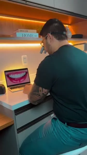 Vídeo Facetas em Resina