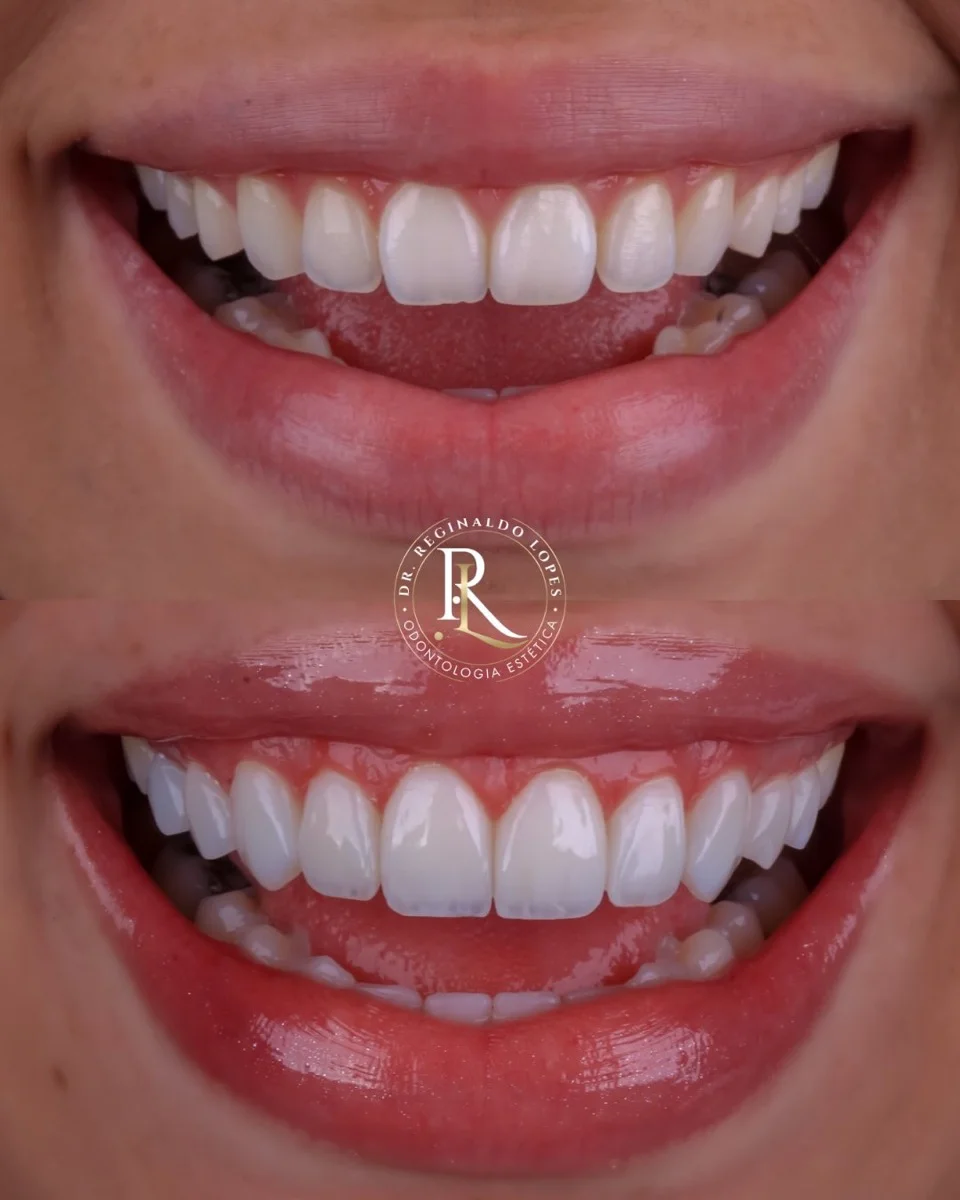 Resultado antes e depois — caso 01