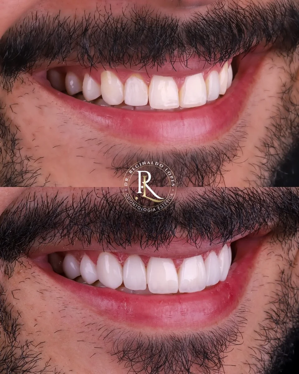 Resultado antes e depois — caso 03