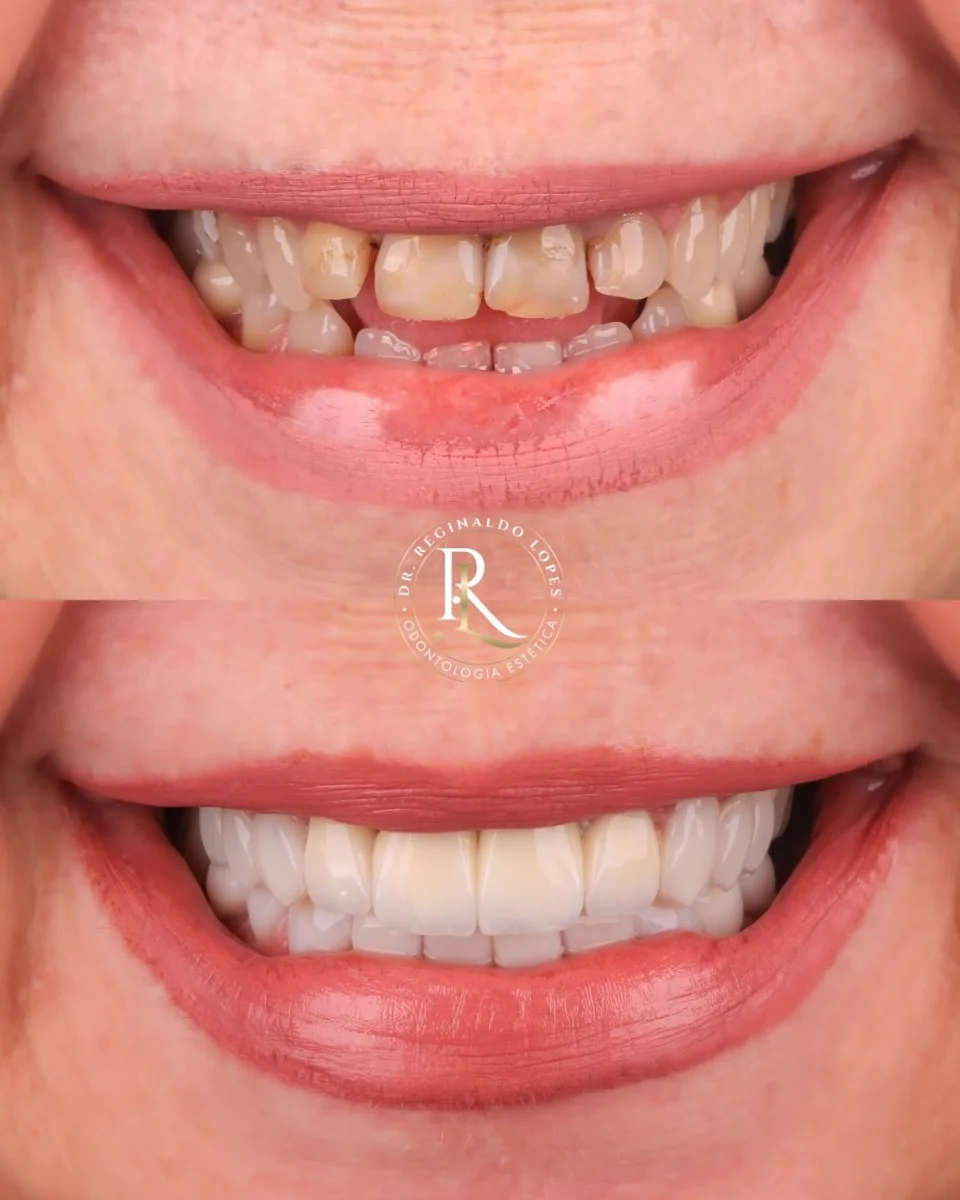 Resultado antes e depois — caso 08