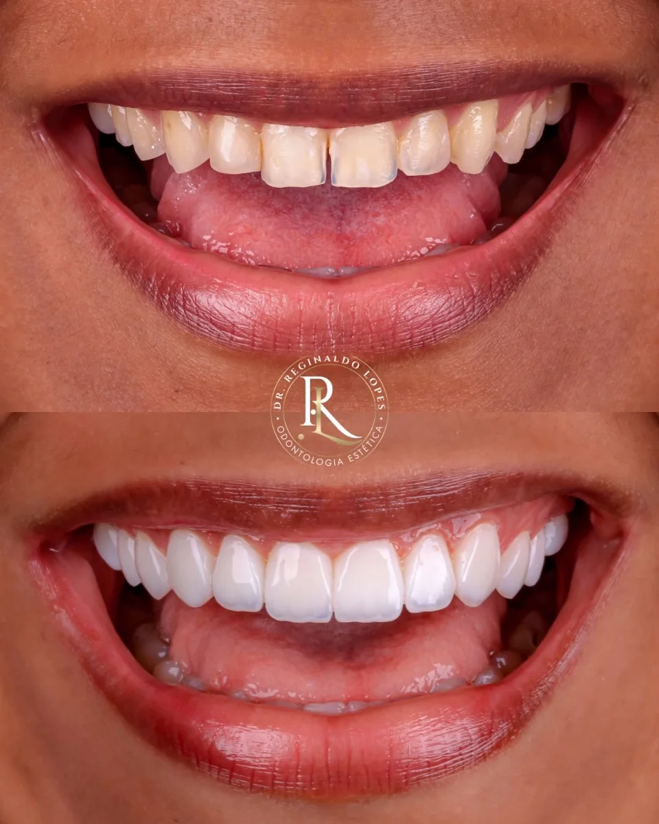 Resultado antes e depois — caso 09