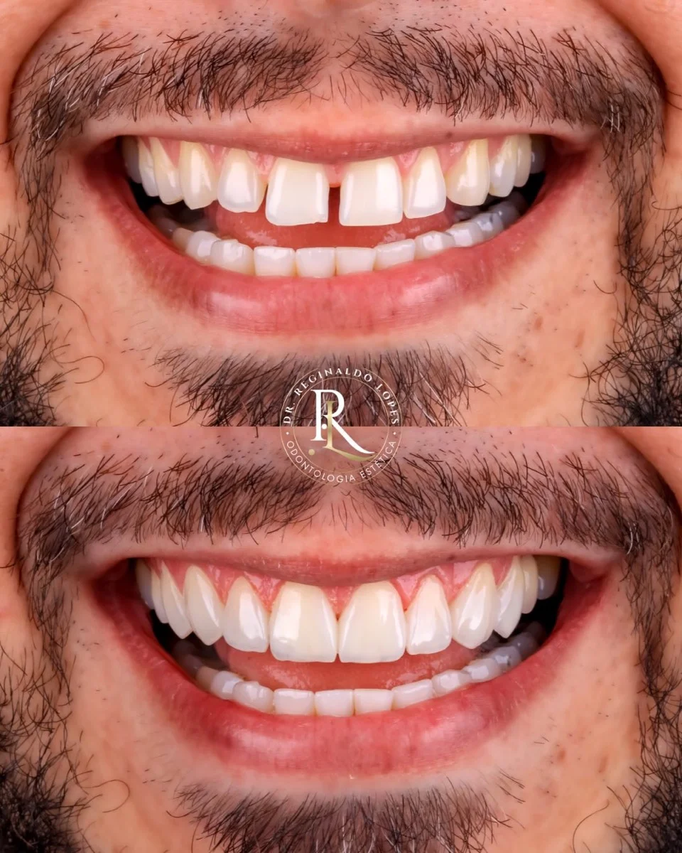 Resultado antes e depois — caso 10