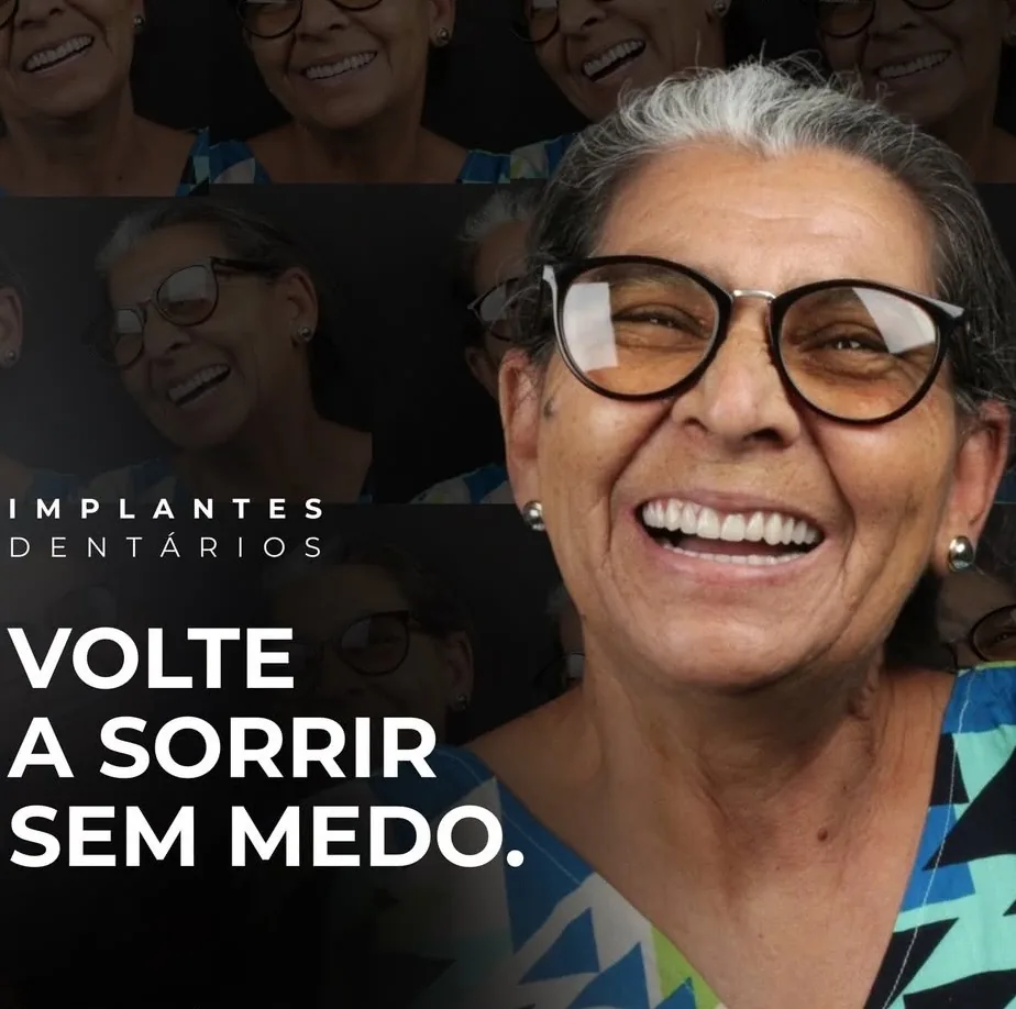 Implantes Dentários